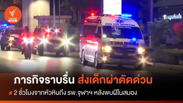 ภารกิจราบรื่น นำเด็ก 1 ขวบครึ่งจากหัวหิน ผ่าตัดด่วน รพ.จุฬาฯ