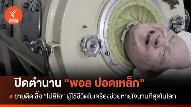 ได้นอนพักจริงๆ แล้วนะ ปิดตำนาน "พอล ปอดเหล็ก" 