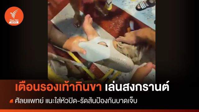 เตือน! สงกรานต์รองเท้ากินขา-เสี่ยงบาดเจ็บ