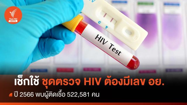 เช็กใช้ "ชุดตรวจ HIV" ต้องมีเลข อย.พบผู้ติดเชื้อ 522,581 คน  