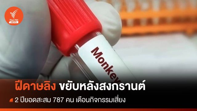 ยอดสะสม 787 คน "ฝีดาษลิง" ไทยตัวเลขขยับหลังสงกรานต์ 