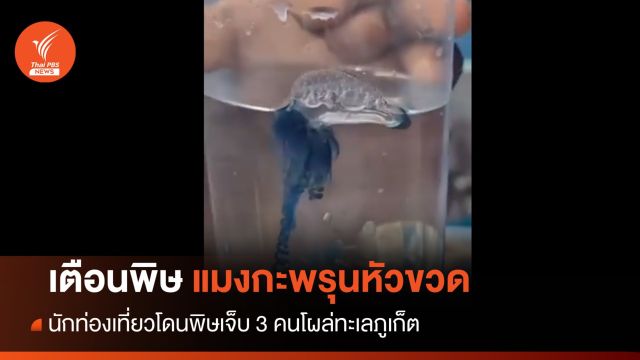 เตือน ! แมงกะพรุนหัวขวดโผล่ทะเลภูเก็ตโดนพิษเจ็บ 3 คน