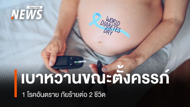 วันเบาหวานโลก รู้จัก "เบาหวานขณะตั้งครรภ์" 1 โรคอันตรายของ 2 ชีวิต