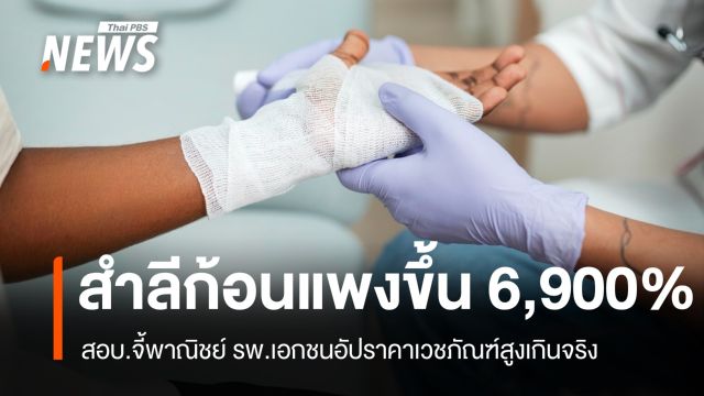 สำลีก้อนละ 7 บาท! สอบ.ชี้ รพ.เอกชนอัปราคาเวชภัณฑ์สูงลิ่ว