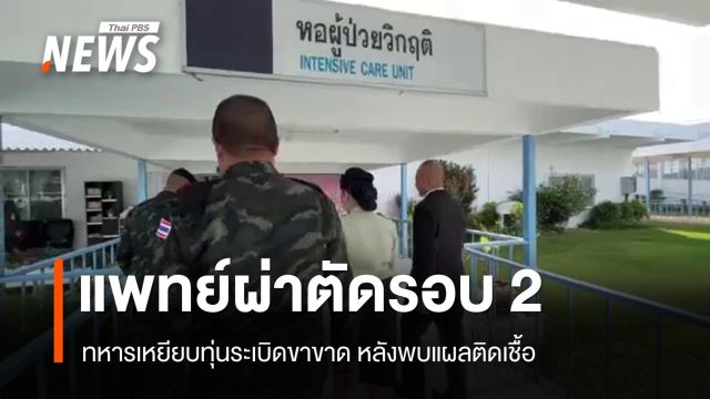 ผ่าตัดรอบ 2 ทหารเหยียบทุ่นระเบิดขาขาด หลังพบแผลติดเชื้อ