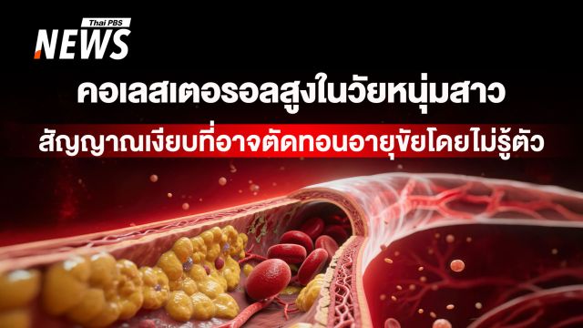 "คอเลสเตอรอลสูง" เมื่อโรคหัวใจเริ่มต้นก่อนวัย ทางรอดอาจอยู่ใน "ยีน"