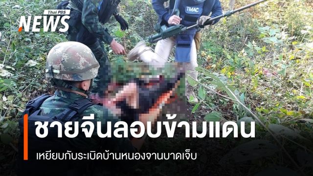 ชายจีนลอบข้ามแดนเหยียบกับระเบิดบ้านหนองจานบาดเจ็บ