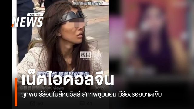 "เน็ตไอดอลจีน" ถูกพบเร่ร่อนในสีหนุวิลล์ ในสภาพซูบผอม-มีร่องรอยบาดเจ็บ