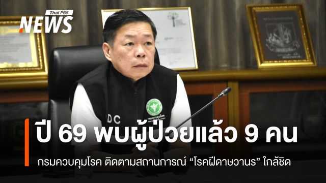 กรมควบคุมโรค เผยปี 69 พบป่วยโรคฝีดาษวานรแล้ว 9 คน  - สถานการณ์ยังควบคุมได้ 
