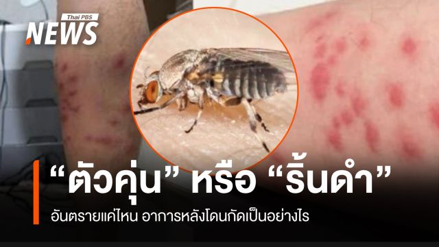 9 เรื่องน่ารู้ของ "ตัวคุ่น" หรือ "ริ้นดำ" อันตรายแค่ไหน อาการหลังโดนกัด 