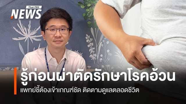 แพทย์ชี้ผ่าตัดรักษาโรคอ้วนต้องเข้าเกณฑ์ชัด ติดตามดูแลตลอดชีวิต