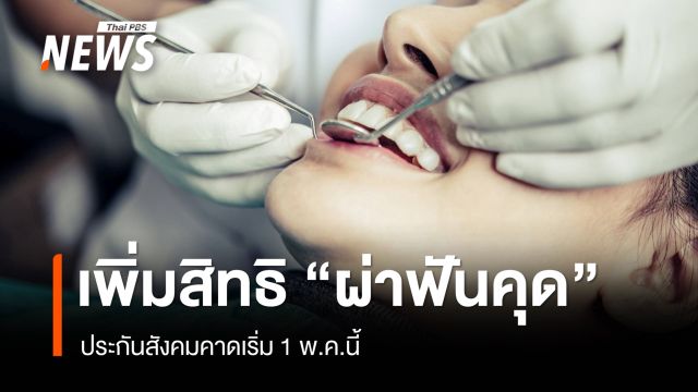 ประกันสังคม เพิ่มสิทธิ "ผ่าฟันคุด" - ไม่ต้องสำรองจ่าย คาดเริ่ม 1 พ.ค.นี้