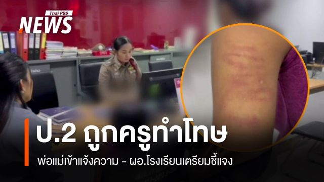 นักเรียน ป.2 ถูกครูทำโทษตีแขนเป็นรอยช้ำ  ผอ.โรงเรียนเตรียมชี้แจง