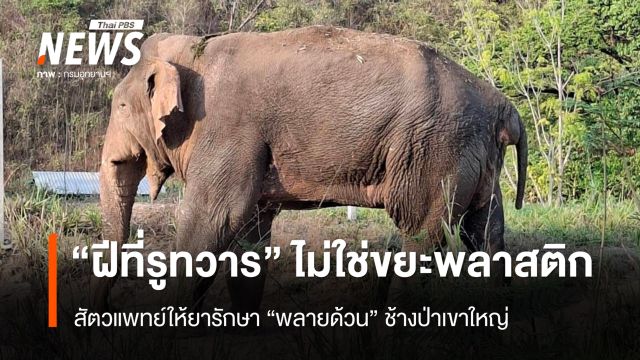 รักษา "พลายด้วน" เป็นฝีที่รูทวาร ไม่ใช่ถ่ายเป็นขยะพลาสติก