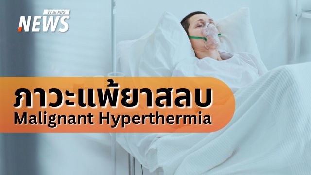 รู้จัก "ภาวะแพ้ยาสลบ Malignant Hyperthermia" ภัยเงียบที่อาจพรากชีวิตในเสี้ยวนาที