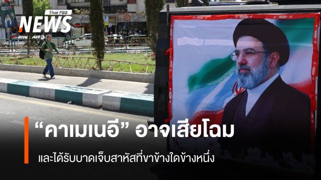 "คาเมเนอี" อาจเสียโฉม และได้รับบาดเจ็บสาหัสที่ขาข้างใดข้างหนึ่ง