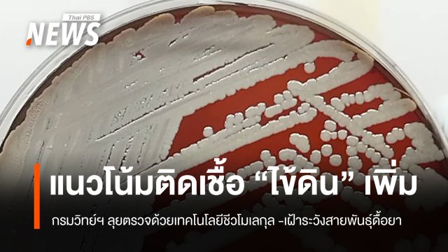 แนวโน้มผู้ติดเชื้อ "ไข้ดิน" เพิ่ม กรมวิทย์ฯ ลุยตรวจ-เฝ้าระวังเชื้อดื้อยา