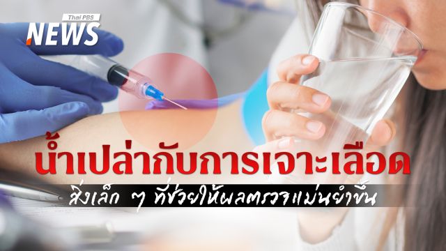 ไขคำตอบ งดดื่มน้ำก่อนเจาะเลือด จำเป็นหรือไม่  ?