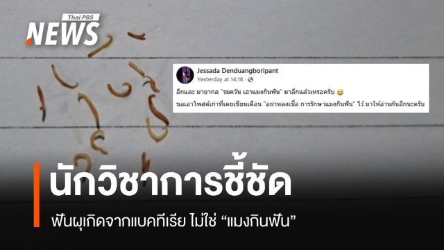 นักวิชาการชี้ชัด ฟันผุเกิดจากแบคทีเรีย ไม่ใช่ "แมงกินฟัน"