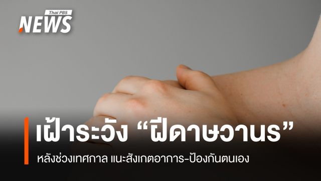 สธ.เฝ้าระวัง "ฝีดาษวานร" หลังช่วงเทศกาล ปี 69 ไทยพบป่วยแล้ว 48 คน